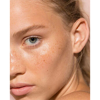 Summer skin rescue